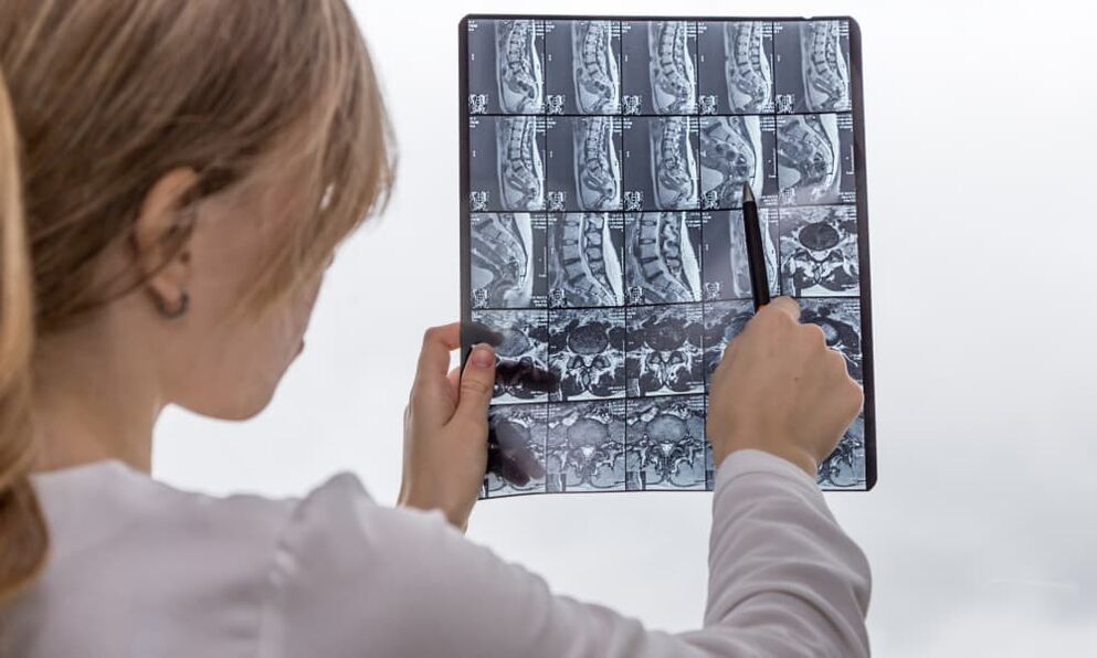 Magnetic resonance imaging helps the doctor detect osteochondrosis and prescribe treatment