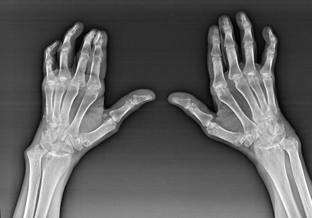 Diagnostics of the finger connections