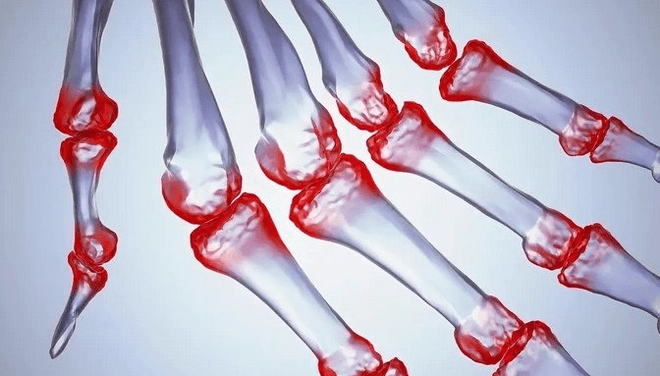 Pain in the fingers of fingers