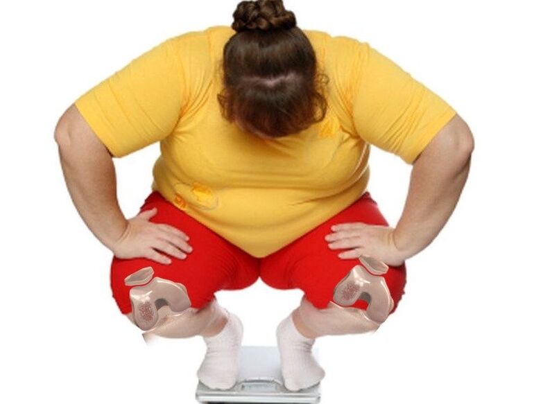 The majority of osteoarthritis patients are overweight or obese