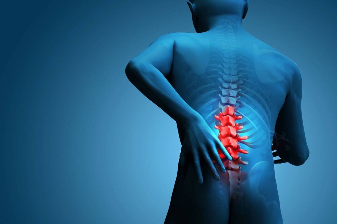 Pain in lumbar osteochondrosis